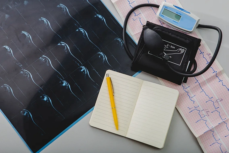 Многосуточное телемониторирование (МТМ) — оптимальный метод контроля при медикаментозном лечении аритмий